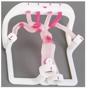 EVIAS Plus - Type III Aortic Arch